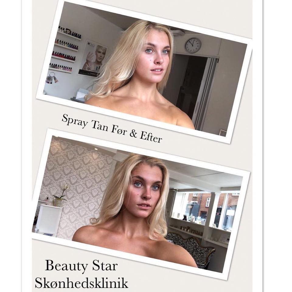 Spraytan før og efter Spray Tan før og efter
